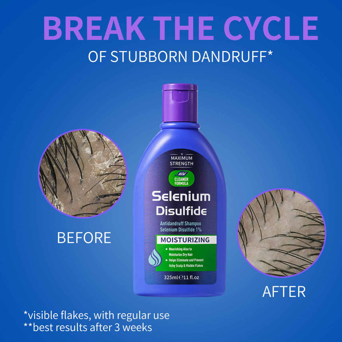 Champú Anticaspa con Disulfuro - Hair Care Dandruff reseña y precio