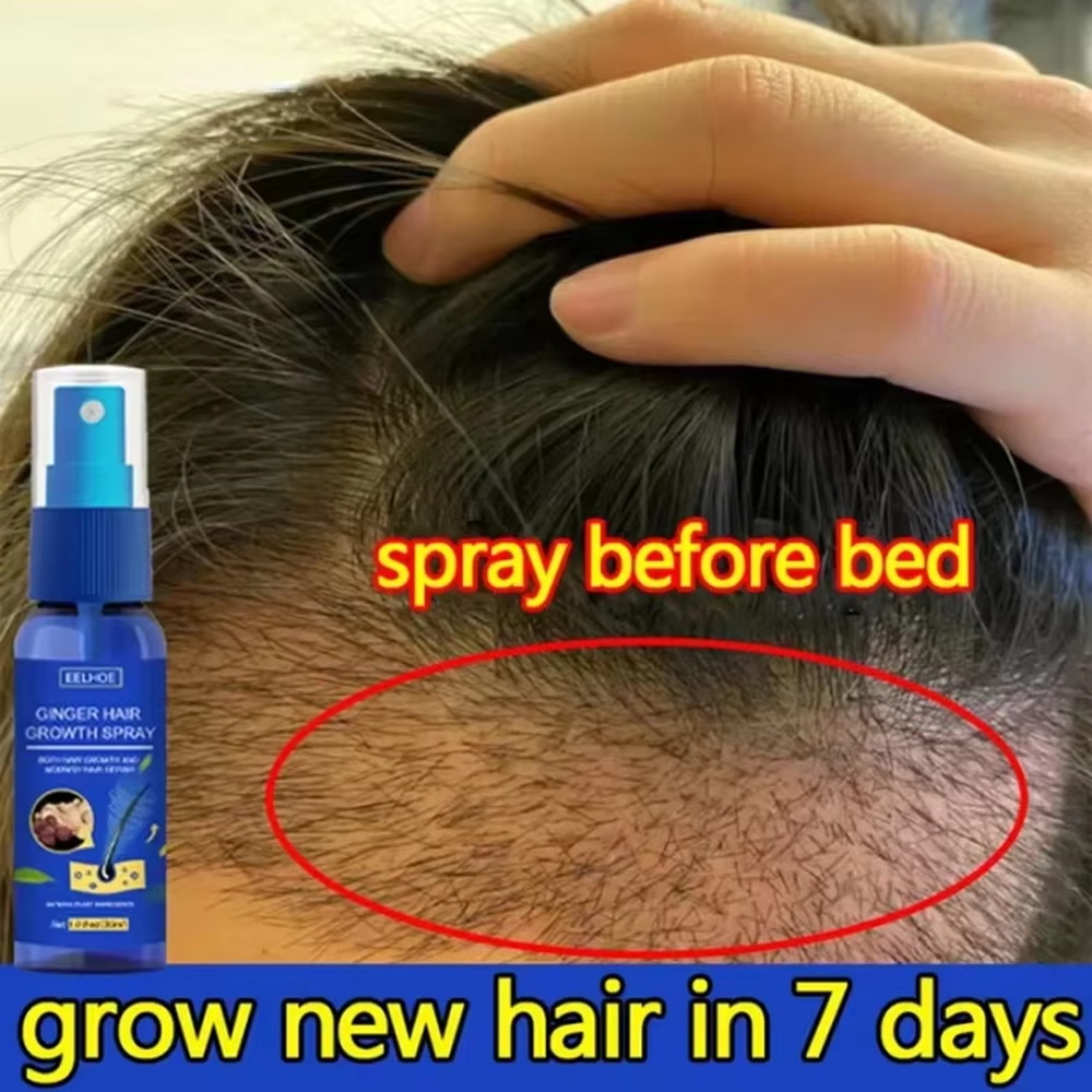 Spray de Crecimiento Rápido de - Hair Care Lotion reseña y precio
